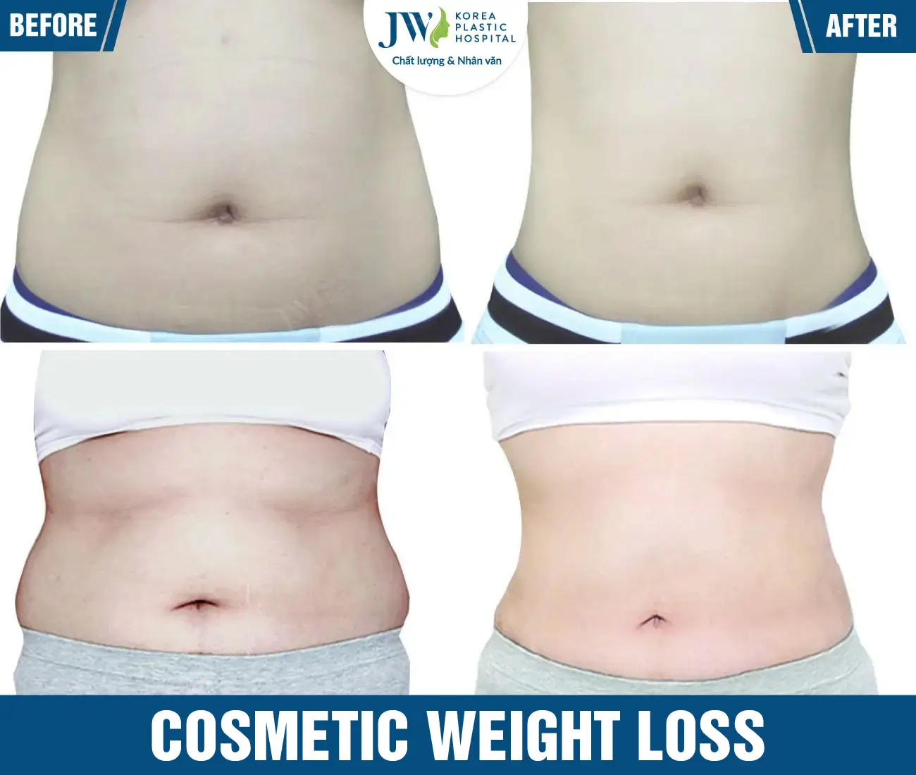 Cosmetic weight loss